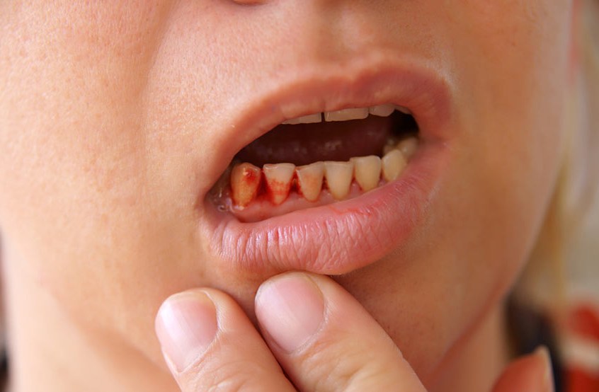 ¿Que casos se consideran urgencia dental Como actuar ante ellas