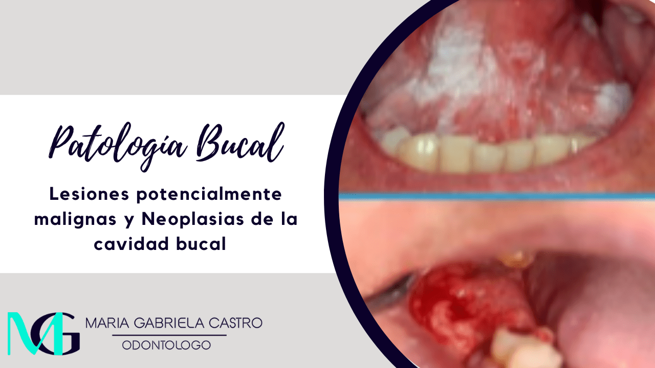 Lesiones potencialmente malignas y Neoplasias de la cavidad bucal