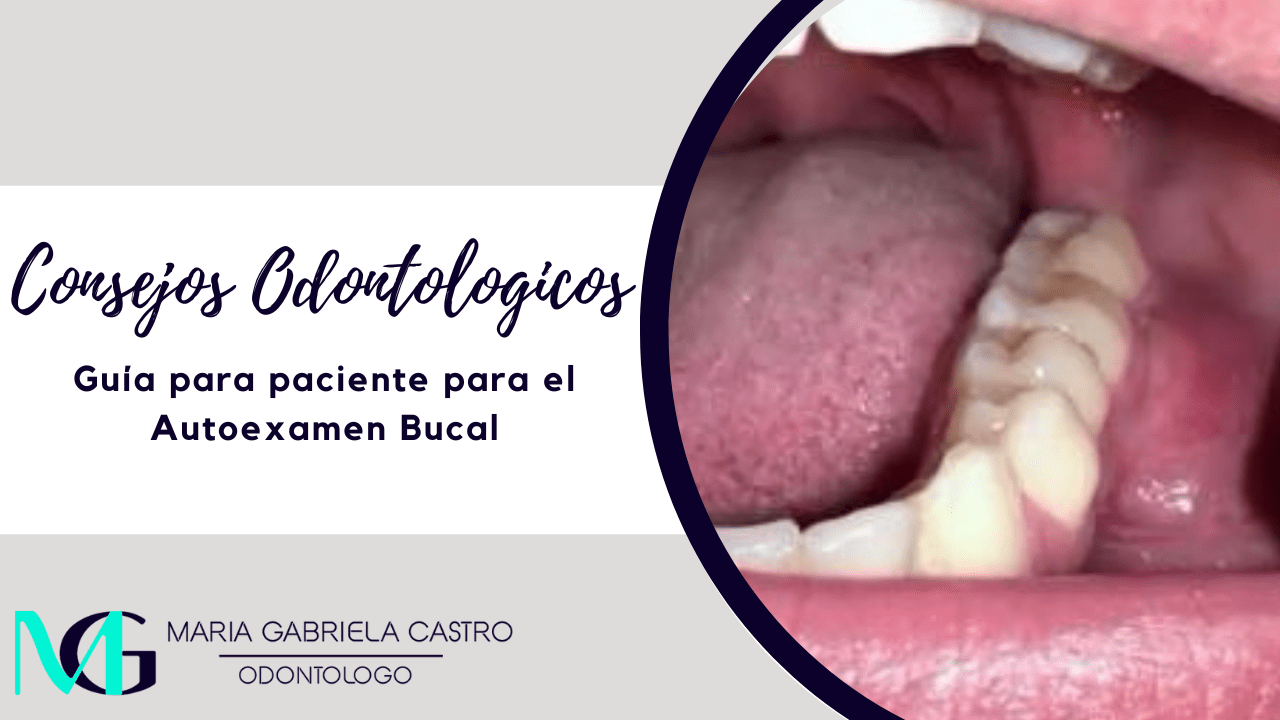 Guía para paciente para el Autoexamen Bucal